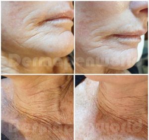 Ageing_Female-21-2