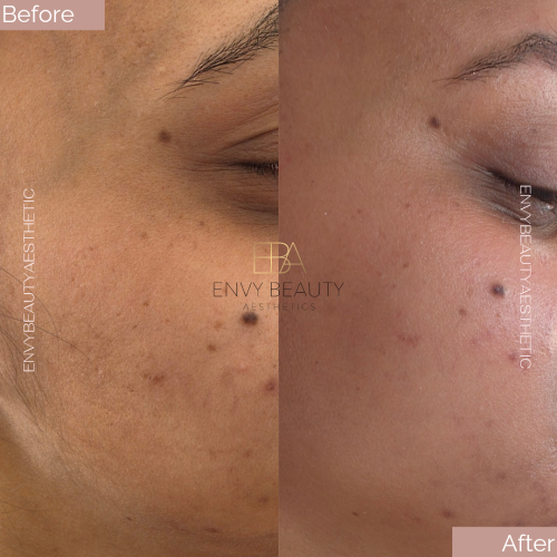 Before and After_20260226_181507_0000