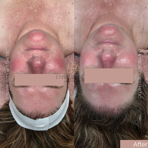 Before and After_20260406_121303_0000