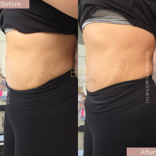 Before and After_20260406_121708_0000